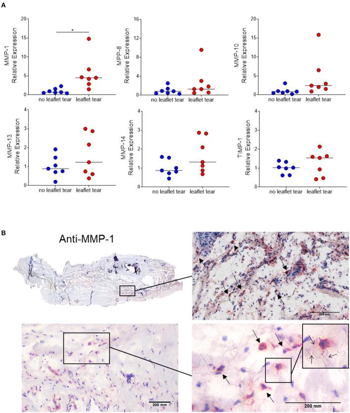https://cdn.ncbi.nlm.nih.gov/pmc/blobs/d593/8811173/78625ddf2f40/fcvm-08-804111-g0003.jpg