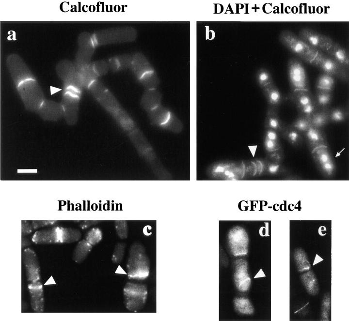 https://cdn.ncbi.nlm.nih.gov/pmc/blobs/d595/2132827/80a32c5b2d63/JCB9803036.f4.jpg