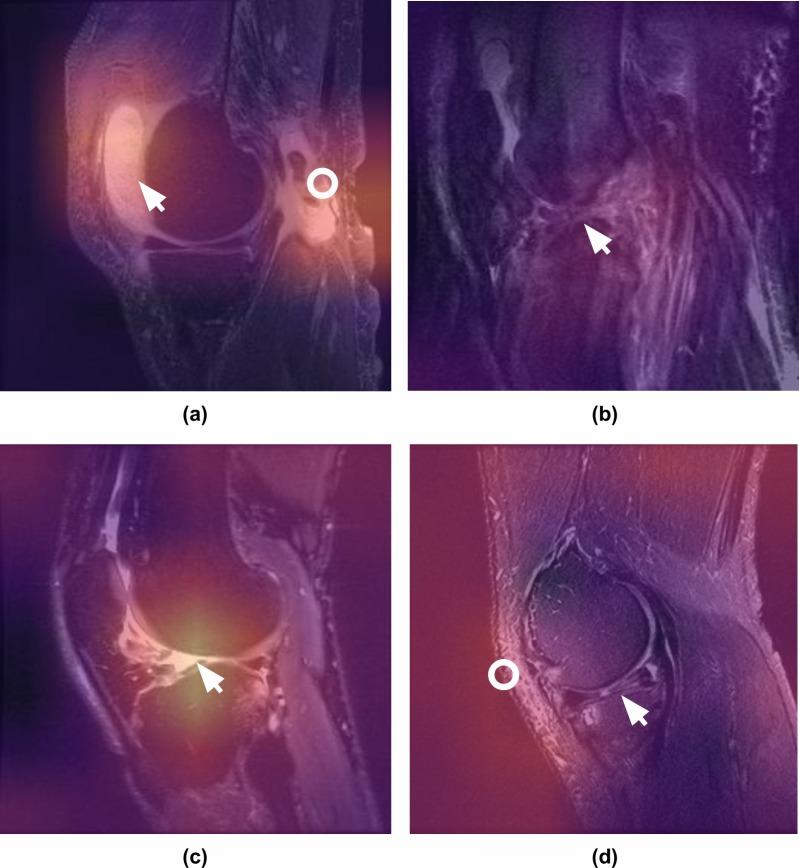https://cdn.ncbi.nlm.nih.gov/pmc/blobs/d595/6258509/eb4af410cee8/pmed.1002699.g003.jpg