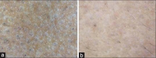 https://cdn.ncbi.nlm.nih.gov/pmc/blobs/d598/5596649/24079f45264e/IJT-9-124-g004.jpg