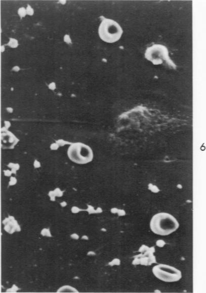 https://cdn.ncbi.nlm.nih.gov/pmc/blobs/d59d/1910818/1e4904fdbe01/amjpathol00474-0168-b.jpg