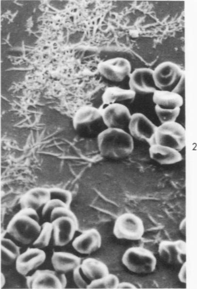 https://cdn.ncbi.nlm.nih.gov/pmc/blobs/d59d/1910818/a071cd0fe655/amjpathol00474-0167-b.jpg