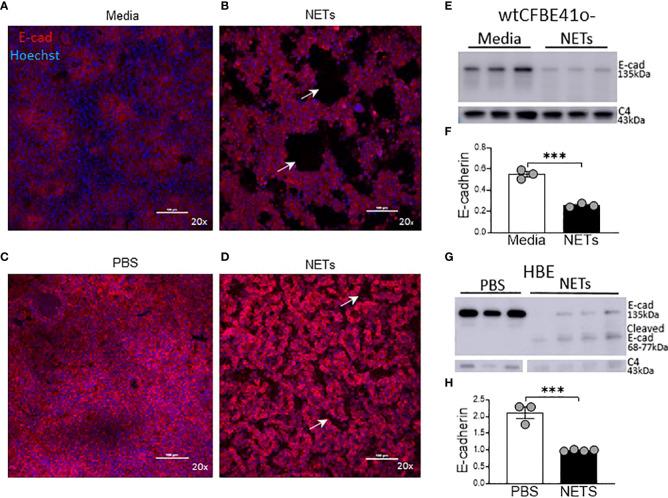 https://cdn.ncbi.nlm.nih.gov/pmc/blobs/d59e/9872031/43321f773a5b/fimmu-13-1023553-g004.jpg