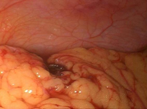 https://cdn.ncbi.nlm.nih.gov/pmc/blobs/d5a7/4382054/1a88d5baf3dc/PAMJ-19-244-g005.jpg