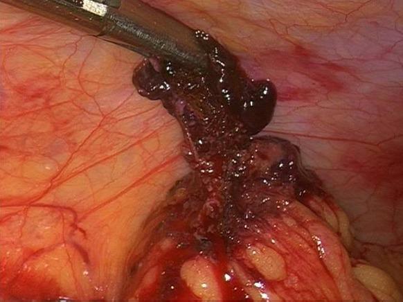 https://cdn.ncbi.nlm.nih.gov/pmc/blobs/d5a7/4382054/b7e2f86811a9/PAMJ-19-244-g004.jpg