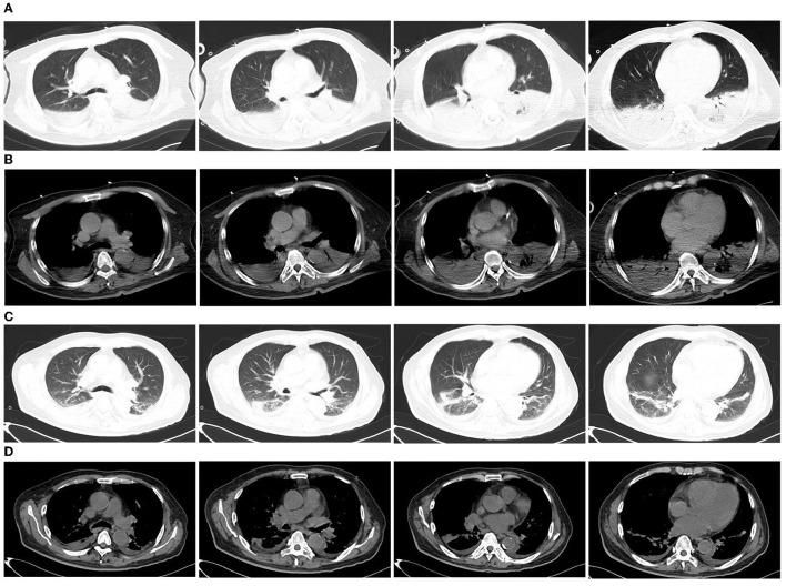 https://cdn.ncbi.nlm.nih.gov/pmc/blobs/d5b6/10205016/d536e78a0757/fpubh-11-1145733-g0001.jpg
