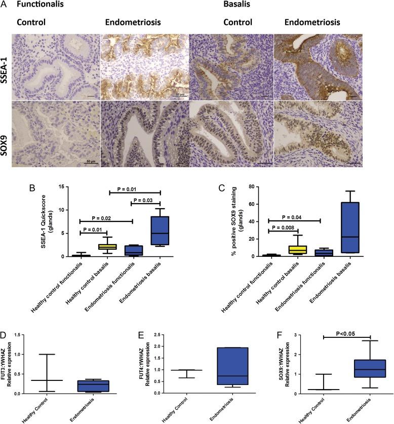 https://cdn.ncbi.nlm.nih.gov/pmc/blobs/d5c1/6295963/0ba2db338c11/dey336f01.jpg