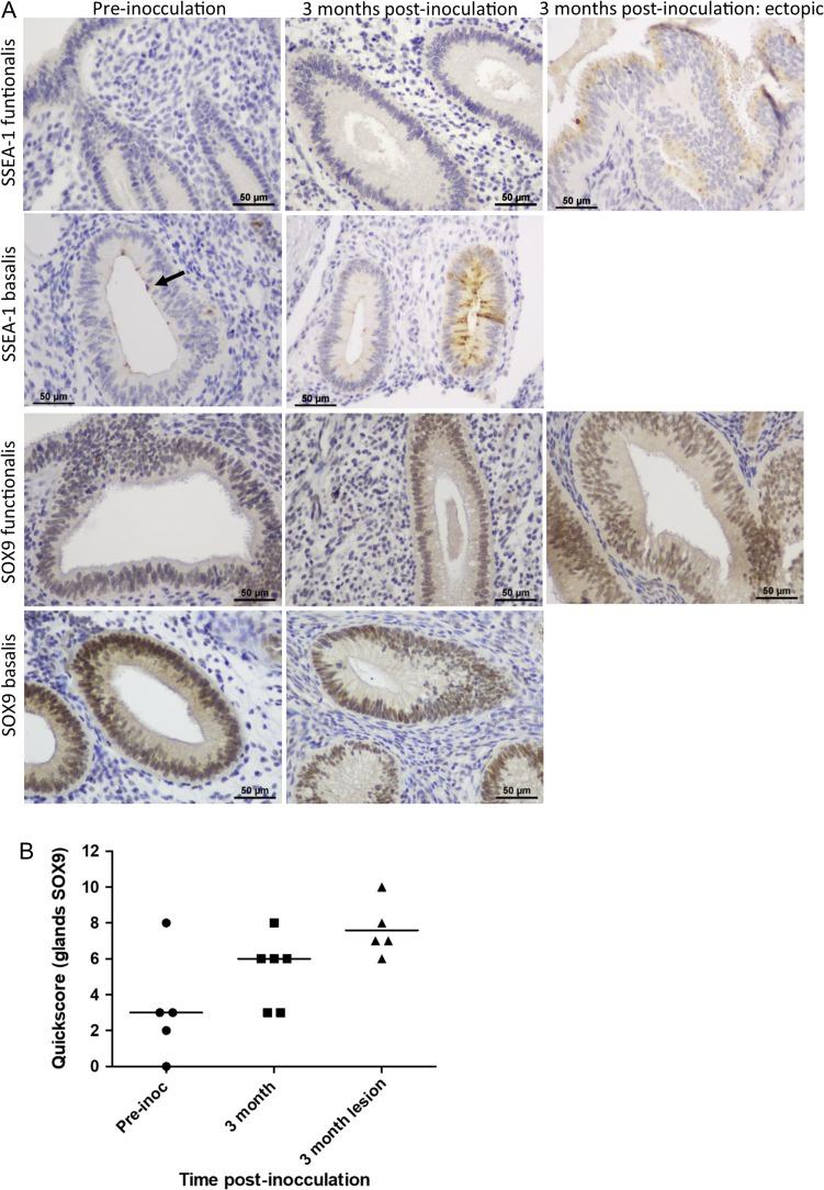 https://cdn.ncbi.nlm.nih.gov/pmc/blobs/d5c1/6295963/f436c45b8b21/dey336f02.jpg