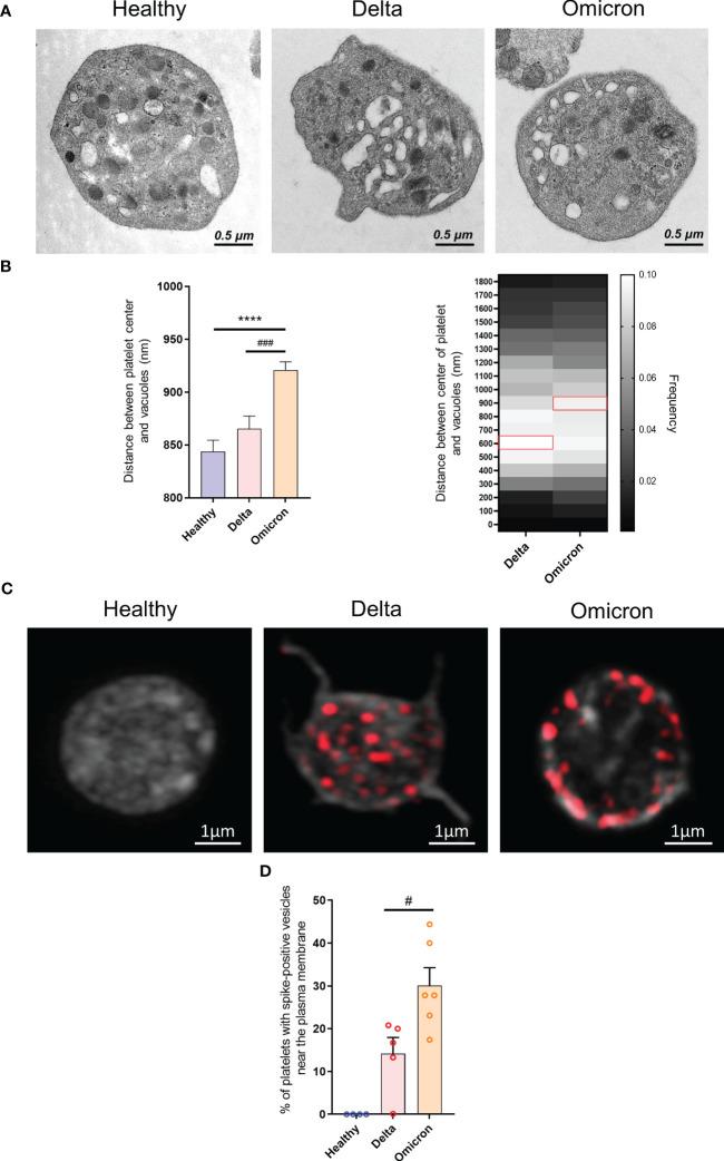 https://cdn.ncbi.nlm.nih.gov/pmc/blobs/d5c2/10565689/3b0e31be5d91/fimmu-14-1231576-g002.jpg