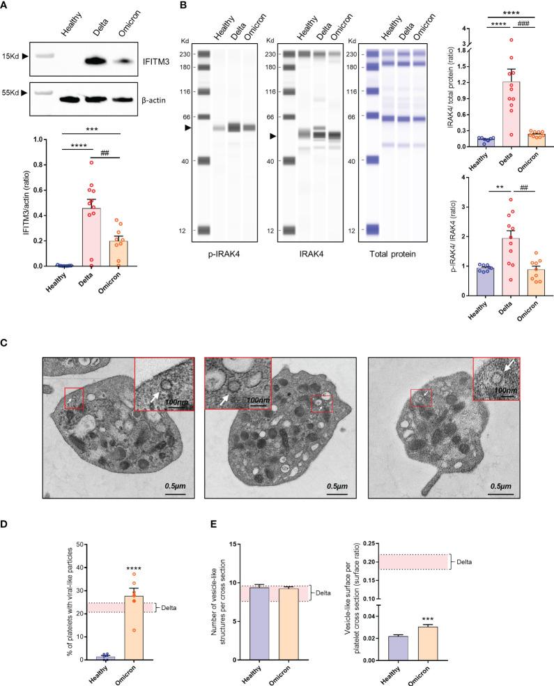 https://cdn.ncbi.nlm.nih.gov/pmc/blobs/d5c2/10565689/8cd3b0e57d1f/fimmu-14-1231576-g001.jpg