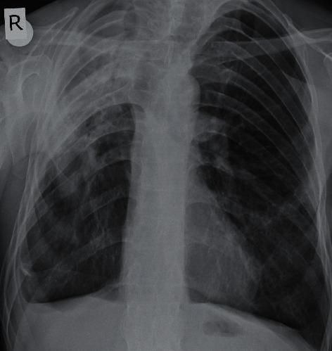 https://cdn.ncbi.nlm.nih.gov/pmc/blobs/d5c2/7512063/389749d36860/CRIRH2020-8852515.001.jpg