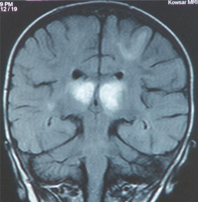 https://cdn.ncbi.nlm.nih.gov/pmc/blobs/d5c5/5329764/1e53318af238/ijcn-11-075-g002.jpg