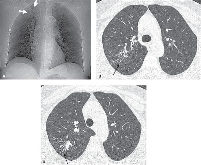 https://cdn.ncbi.nlm.nih.gov/pmc/blobs/d5cf/11235070/158ecdf70199/rb-57-e20230124-g03.jpg