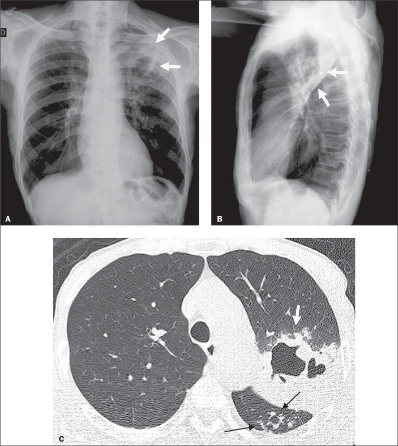 https://cdn.ncbi.nlm.nih.gov/pmc/blobs/d5cf/11235070/b25adeaf2629/rb-57-e20230124-g01.jpg