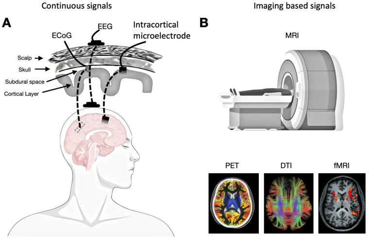 https://cdn.ncbi.nlm.nih.gov/pmc/blobs/d5d8/11854896/cb4f23514b18/entropy-27-00115-g002.jpg