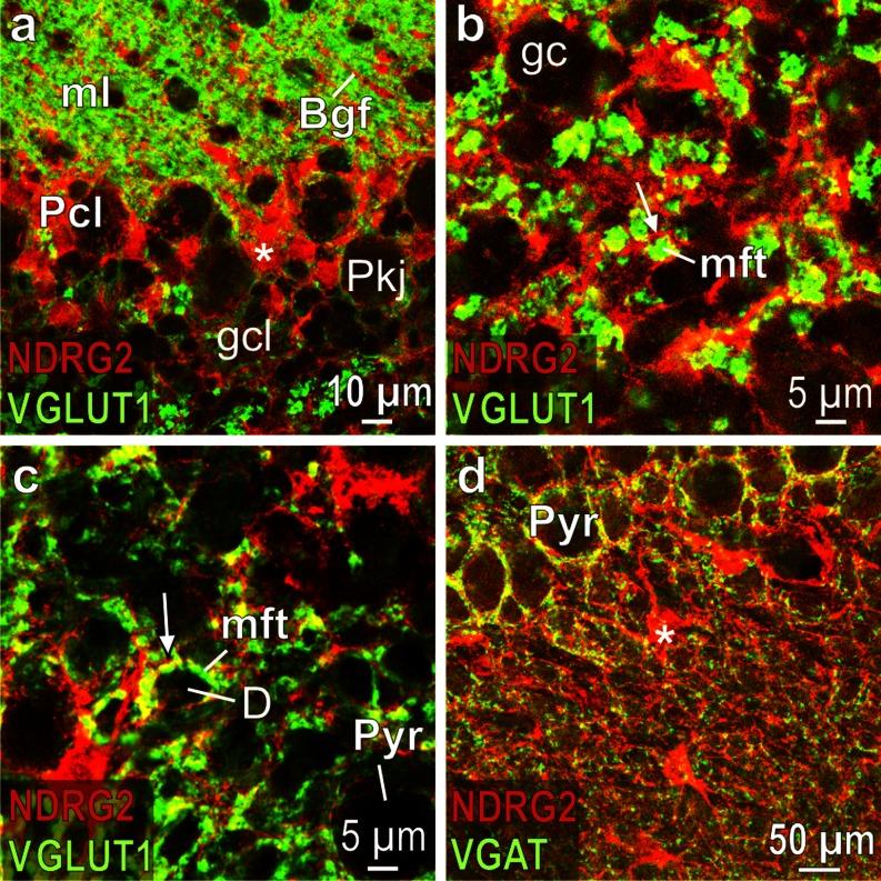 https://cdn.ncbi.nlm.nih.gov/pmc/blobs/d5e4/4077251/881e9a044941/441_2014_1837_Fig6_HTML.jpg