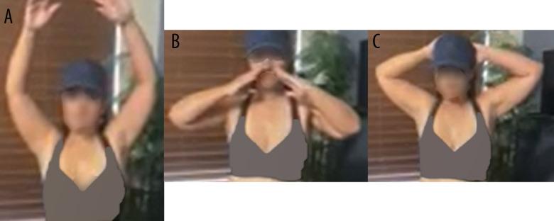 https://cdn.ncbi.nlm.nih.gov/pmc/blobs/d5e5/10126866/c12826b79995/amjcaserep-24-e938650-g002.jpg