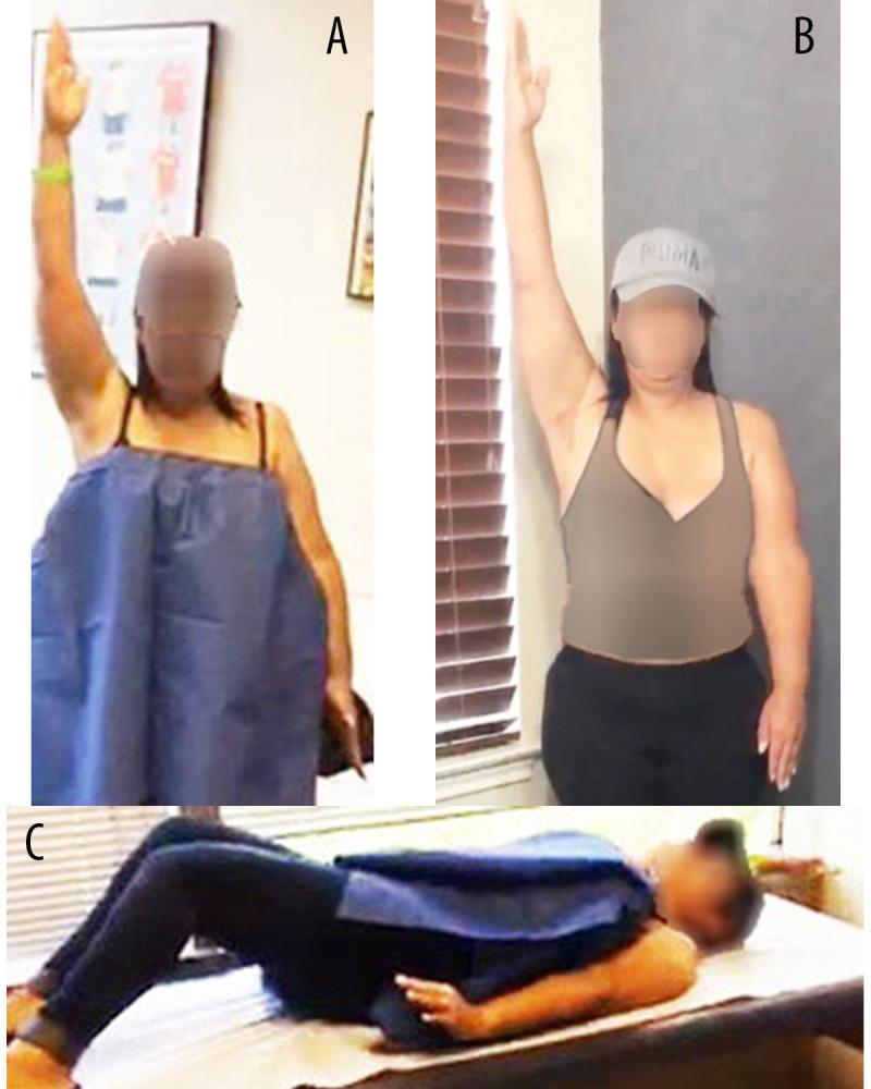 https://cdn.ncbi.nlm.nih.gov/pmc/blobs/d5e5/10126866/f13864807d24/amjcaserep-24-e938650-g001.jpg