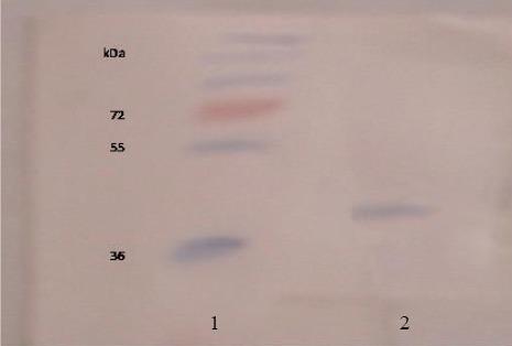 https://cdn.ncbi.nlm.nih.gov/pmc/blobs/d5ed/5569598/3e7d72817c3d/IJBMS-20-791-g006.jpg