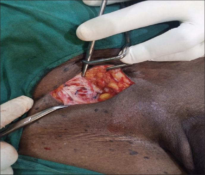 https://cdn.ncbi.nlm.nih.gov/pmc/blobs/d5f2/9671180/7b999141fcc5/AAM-21-288-g001.jpg