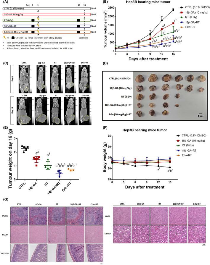 https://cdn.ncbi.nlm.nih.gov/pmc/blobs/d5f4/10243161/02fb39babad7/JCMM-27-1539-g001.jpg