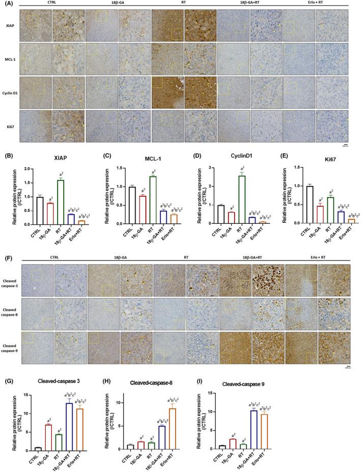 https://cdn.ncbi.nlm.nih.gov/pmc/blobs/d5f4/10243161/9aebb8389978/JCMM-27-1539-g004.jpg