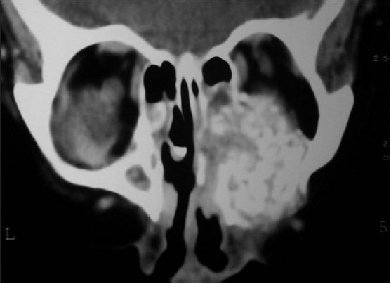 https://cdn.ncbi.nlm.nih.gov/pmc/blobs/d5f5/3927364/b60d36a204f5/JOMFP-17-479a-g003.jpg