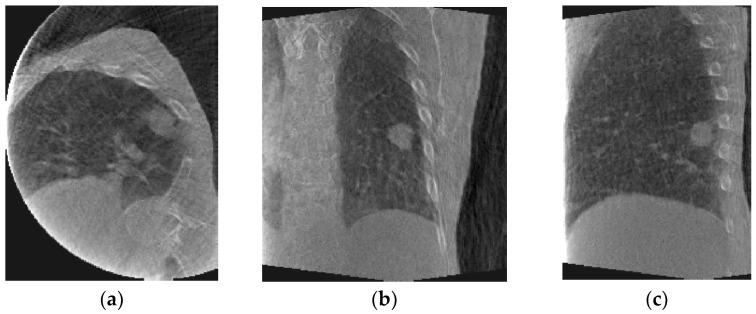 https://cdn.ncbi.nlm.nih.gov/pmc/blobs/d5fc/8879782/1a0864c76cf6/jimaging-08-00017-g005.jpg