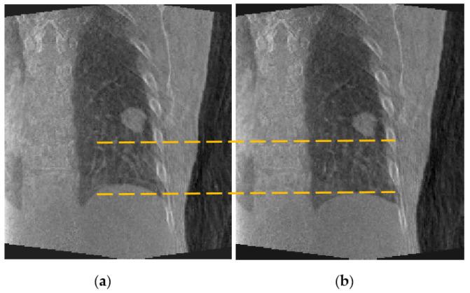 https://cdn.ncbi.nlm.nih.gov/pmc/blobs/d5fc/8879782/2f82a8fdd910/jimaging-08-00017-g006.jpg