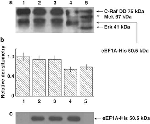 https://cdn.ncbi.nlm.nih.gov/pmc/blobs/d5fd/3317347/e00dfd3afd34/cddis201216f2.jpg