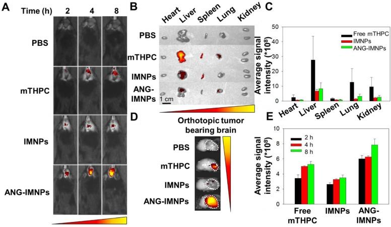 https://cdn.ncbi.nlm.nih.gov/pmc/blobs/d5fe/5835948/21dbf34d7807/thnov08p1435g006.jpg