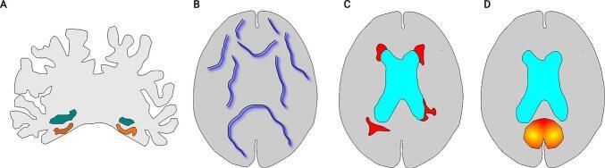 https://cdn.ncbi.nlm.nih.gov/pmc/blobs/d610/12144455/963a7dc2ab28/gr2.jpg