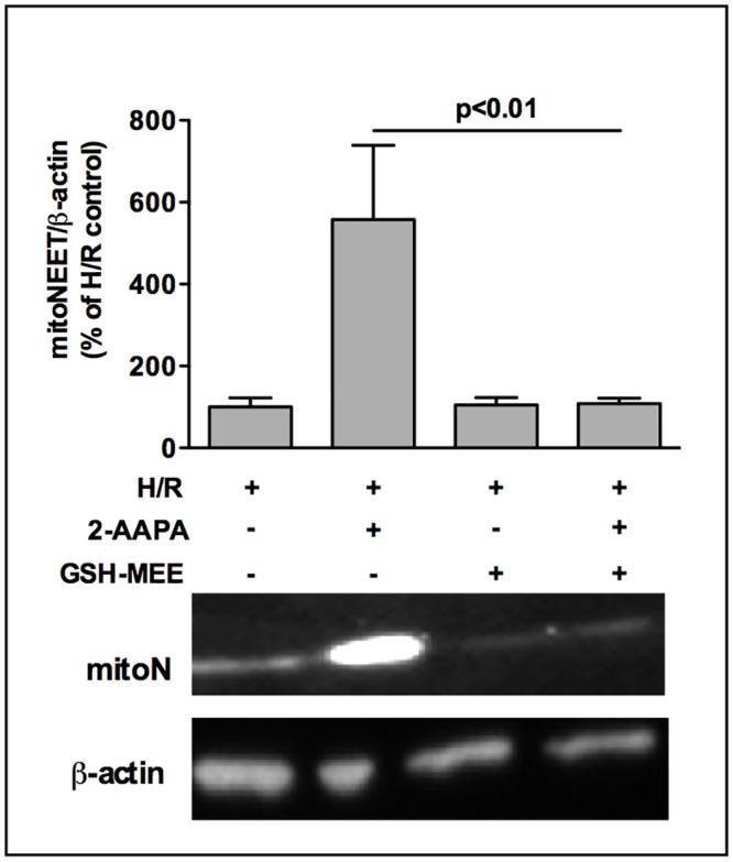 https://cdn.ncbi.nlm.nih.gov/pmc/blobs/d615/4887087/21535a9e2d5d/pone.0156054.g006.jpg