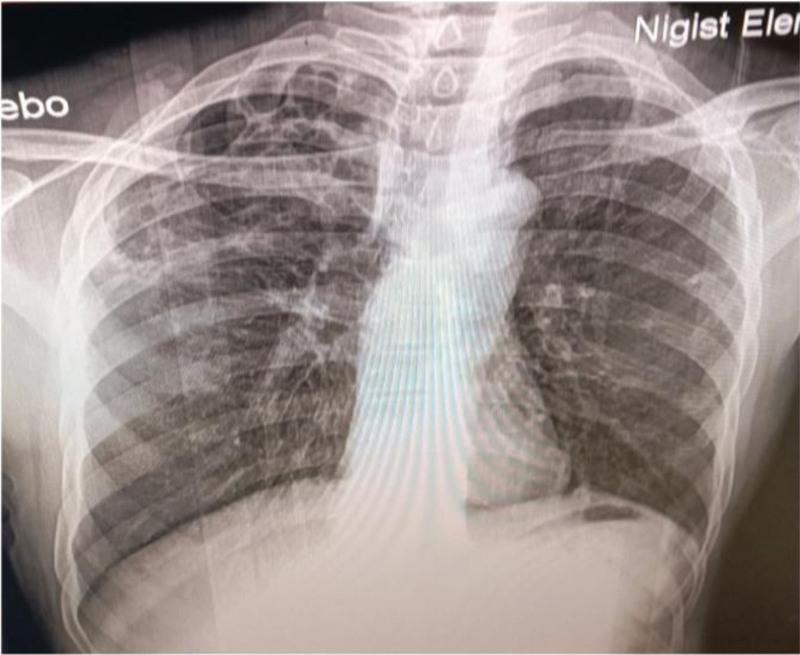 https://cdn.ncbi.nlm.nih.gov/pmc/blobs/d616/12150930/20bdb7c357e6/medi-104-e42823-g002.jpg