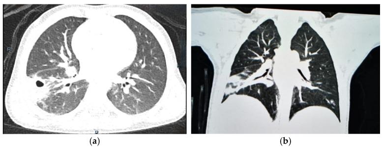 https://cdn.ncbi.nlm.nih.gov/pmc/blobs/d61e/11727648/6f96bfeba9bf/jcm-13-07790-g004.jpg
