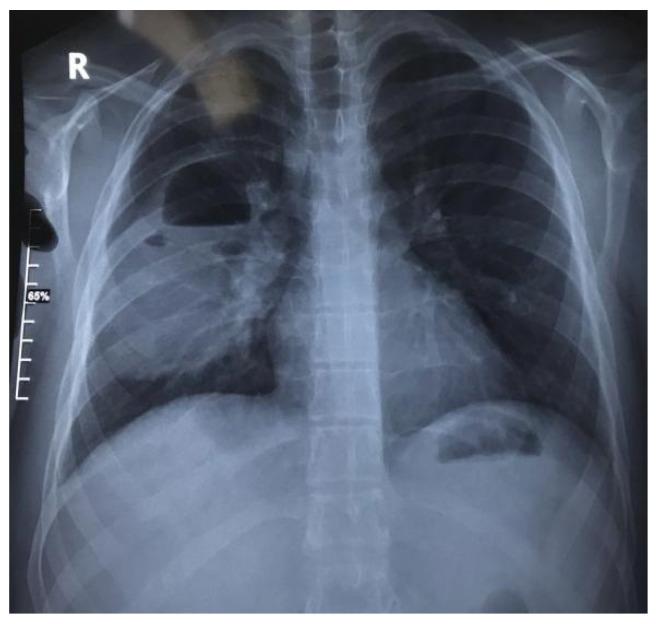 https://cdn.ncbi.nlm.nih.gov/pmc/blobs/d61e/11727648/b38e69f41257/jcm-13-07790-g006.jpg