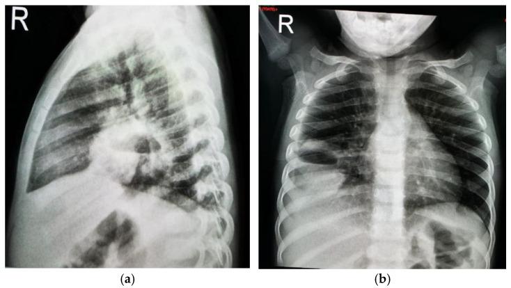 https://cdn.ncbi.nlm.nih.gov/pmc/blobs/d61e/11727648/f6be6e337be7/jcm-13-07790-g001.jpg
