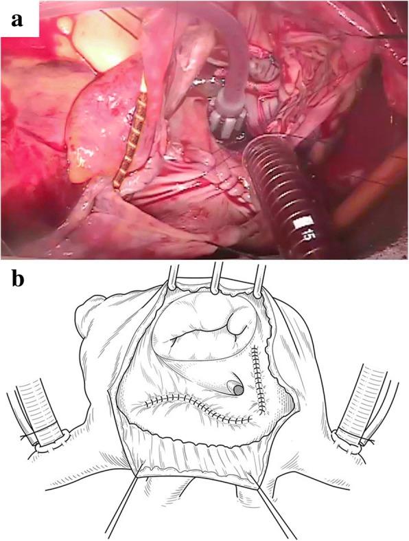 https://cdn.ncbi.nlm.nih.gov/pmc/blobs/d624/6029170/2217295df766/13019_2018_769_Fig4_HTML.jpg