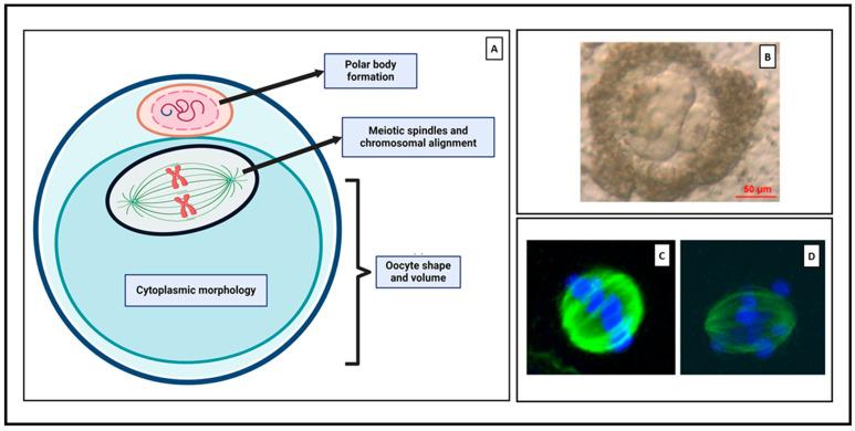 https://cdn.ncbi.nlm.nih.gov/pmc/blobs/d625/10970962/125165a439f0/jcm-13-01791-g004.jpg