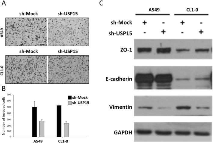 https://cdn.ncbi.nlm.nih.gov/pmc/blobs/d62a/12322926/5bce1f4cf8b7/CAM4-14-e71055-g006.jpg
