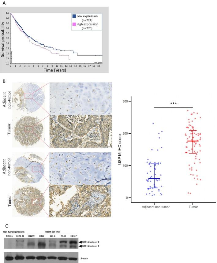 https://cdn.ncbi.nlm.nih.gov/pmc/blobs/d62a/12322926/c1c762e1c1ea/CAM4-14-e71055-g005.jpg