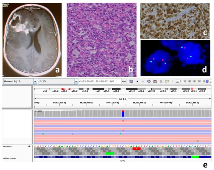https://cdn.ncbi.nlm.nih.gov/pmc/blobs/d636/9028123/05114f181527/genes-13-00624-g001.jpg