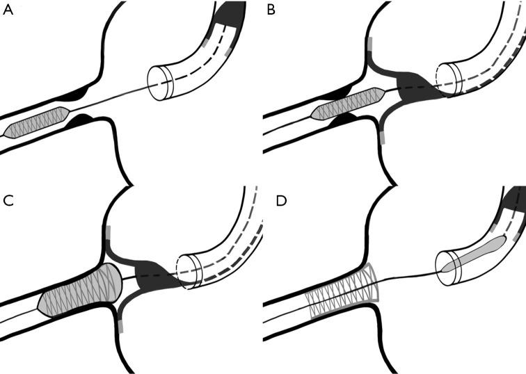 https://cdn.ncbi.nlm.nih.gov/pmc/blobs/d637/10478020/4e23fc5c9c61/cdt-13-04-650-f2.jpg
