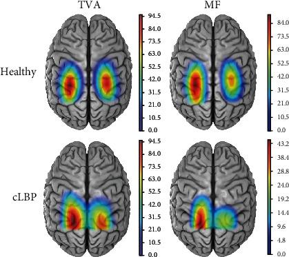 https://cdn.ncbi.nlm.nih.gov/pmc/blobs/d637/7906820/4b4768f0ca72/NP2021-6666024.002.jpg