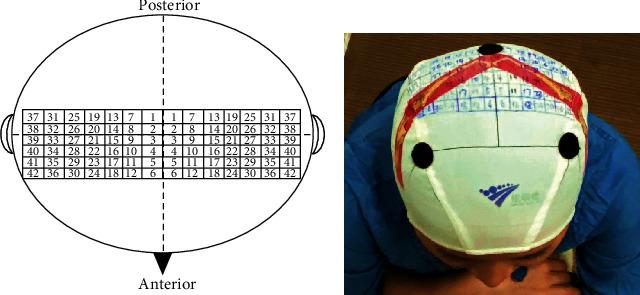 https://cdn.ncbi.nlm.nih.gov/pmc/blobs/d637/7906820/fbf9936d8132/NP2021-6666024.001.jpg