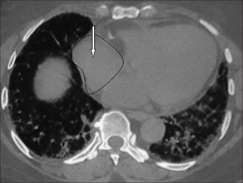 https://cdn.ncbi.nlm.nih.gov/pmc/blobs/d63d/5946554/177b447c648b/LI-35-215-g008.jpg