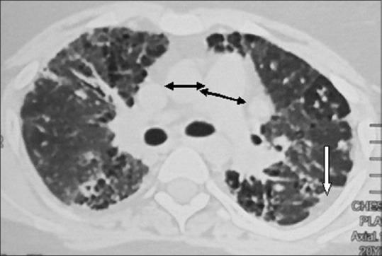 https://cdn.ncbi.nlm.nih.gov/pmc/blobs/d63d/5946554/5e3b0f1ebd43/LI-35-215-g006.jpg