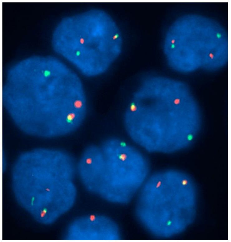 https://cdn.ncbi.nlm.nih.gov/pmc/blobs/d63e/10856720/92cf55324173/jcm-13-00876-g007.jpg