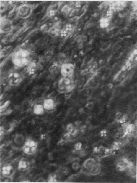 https://cdn.ncbi.nlm.nih.gov/pmc/blobs/d640/333265/95f527107dca/jcinvest00646-0245-b.jpg