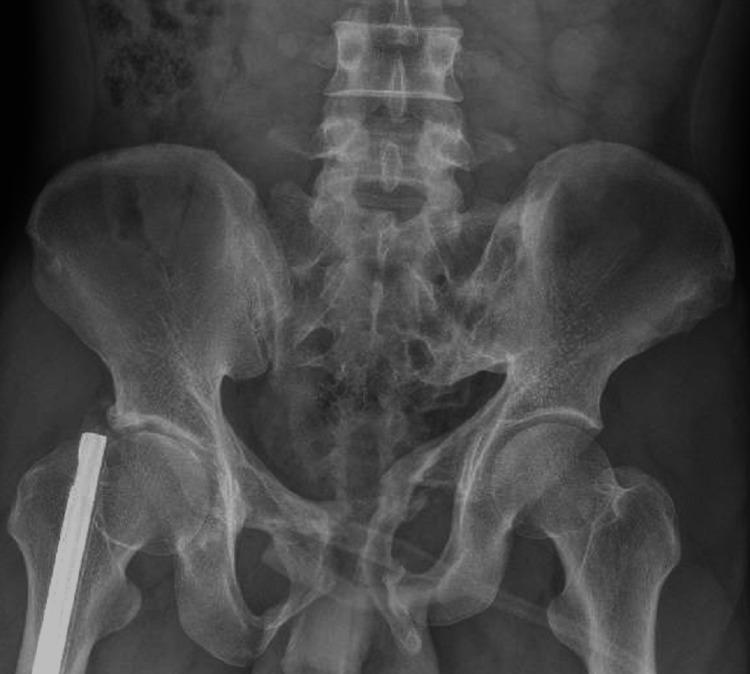 https://cdn.ncbi.nlm.nih.gov/pmc/blobs/d644/9550429/e973c3ad1039/cureus-0014-00000030151-i01.jpg